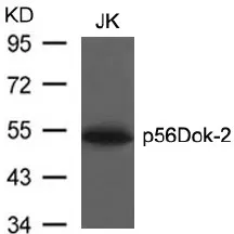 DOK2 Rabbit Polyclonal Antibody - image 1