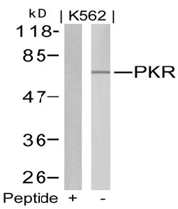 PKR (EIF2AK2) Rabbit Polyclonal Antibody - image 1