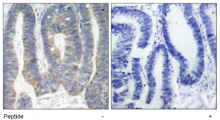 PKR (EIF2AK2) Rabbit Polyclonal Antibody - image 1