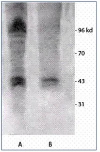 Phosphothreonine Rabbit Polyclonal Antibody - image 1