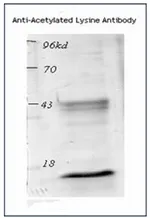 Acetylated Lysine Rabbit Polyclonal Antibody - image 1