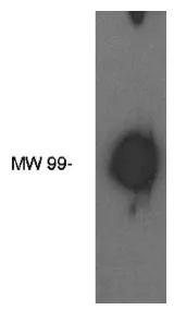 ENPP2 Rabbit Polyclonal Antibody - image 1