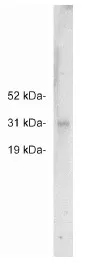 FHL2 Rabbit Polyclonal Antibody - image 1
