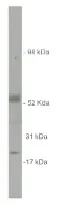 Sulfatase 2 (SULF2) Rabbit Polyclonal Antibody - image 1