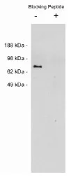 Netrin 1 (NTN1) Rabbit Polyclonal Antibody - image 1