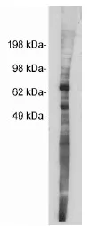 Netrin 1 (NTN1) Rabbit Polyclonal Antibody - image 1