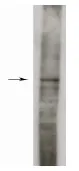 Sphk1 (Long Form) Rabbit Polyclonal Antibody - image 1