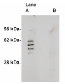 Sphingomyelin Synthase 2 (SGMS2) Rabbit Polyclonal Antibody - image 1