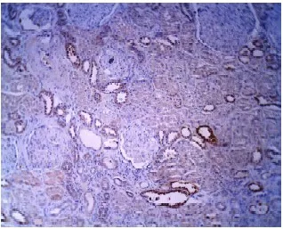 Sphingomyelin Synthase 1 (SGMS1) Rabbit Polyclonal Antibody - image 1