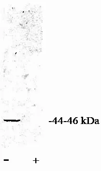 PP2A-alpha (PPP2CA) Rabbit Polyclonal Antibody - image 1
