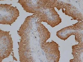 Prostate Specific Antigen (KLK3) Sheep Polyclonal Antibody - image 1
