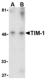 TIM 1 (HAVCR1) Rabbit Polyclonal Antibody - image 1