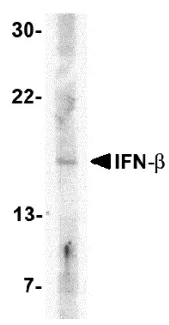 Interferon beta (IFNB1) Rabbit Polyclonal Antibody - image 1