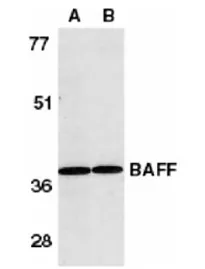 BAFF (TNFSF13B) Rabbit Polyclonal Antibody - image 1