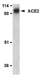 Angiotensin Converting Enzyme 2 (ACE2) Rabbit Polyclonal Antibody - image 1