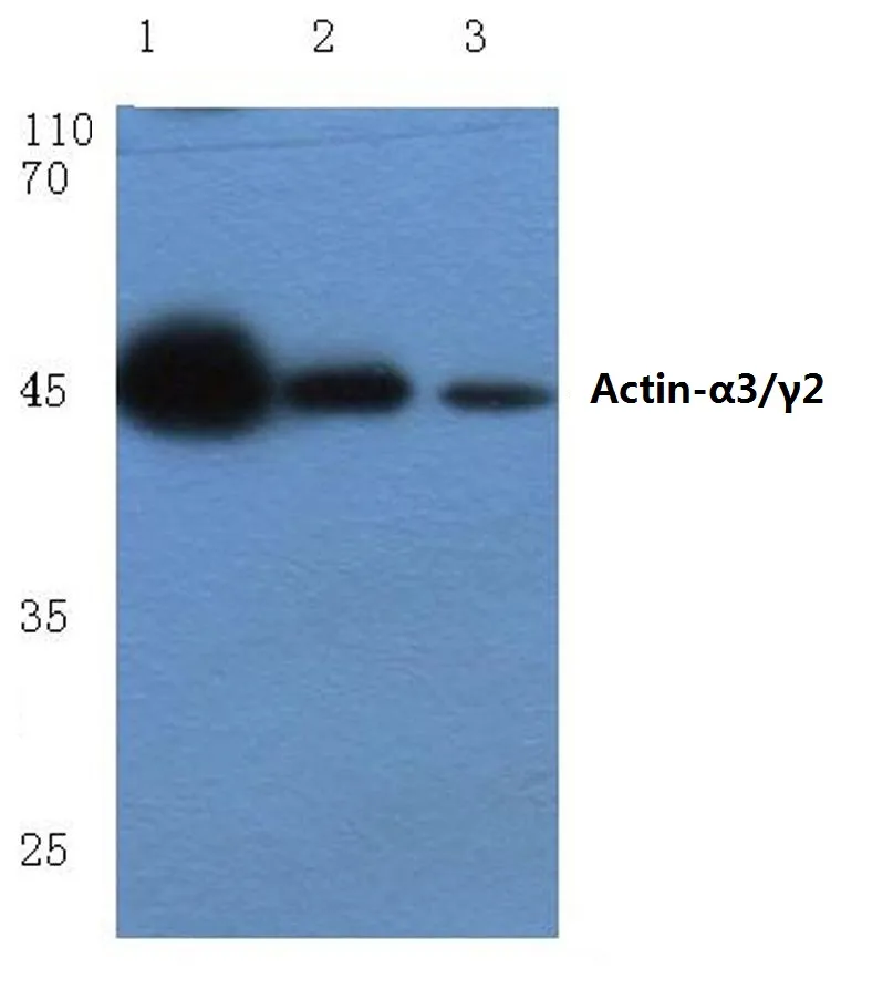 ACTG2 Rabbit Polyclonal Antibody - image 1