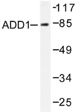 alpha Adducin (ADD1) Rabbit Polyclonal Antibody - image 1