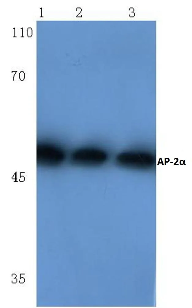 AP2 alpha (TFAP2A) Rabbit Polyclonal Antibody - image 1
