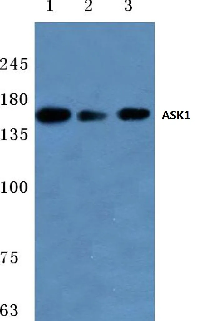 ASK1 (MAP3K5) Rabbit Polyclonal Antibody - image 1