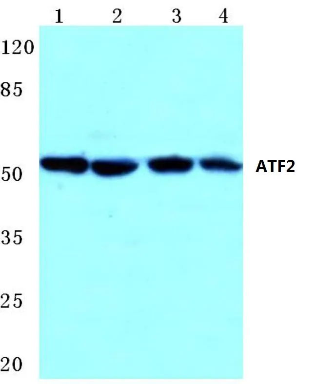ATF2 Rabbit Polyclonal Antibody - image 1