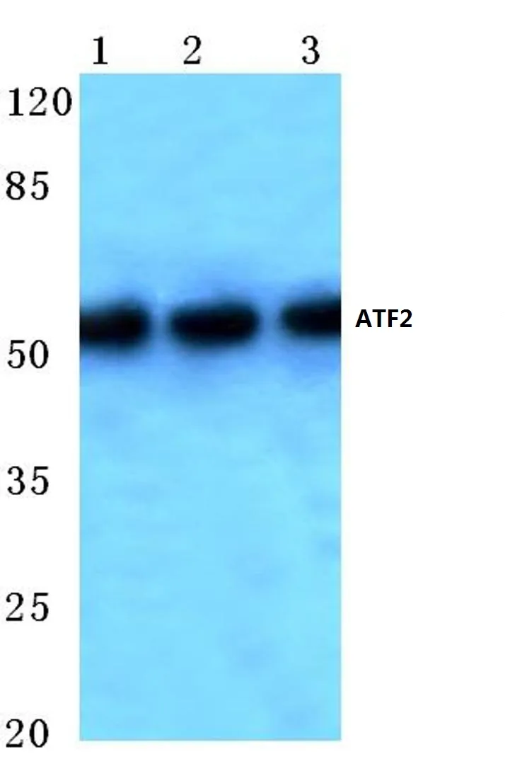 ATF2 Rabbit Polyclonal Antibody - image 1