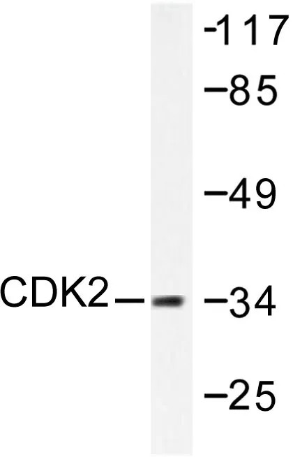 CDK2 Rabbit Polyclonal Antibody - image 1