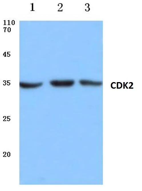 CDK2 Rabbit Polyclonal Antibody - image 1