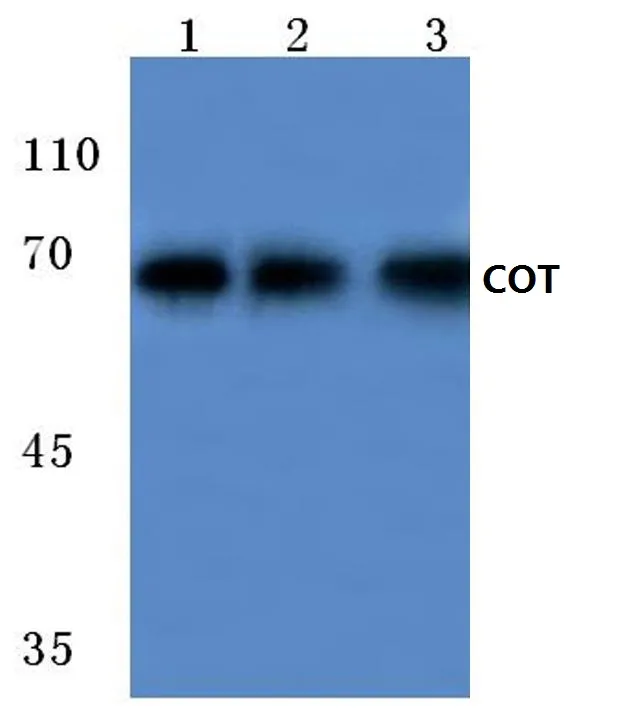 MAP3K8 Rabbit Polyclonal Antibody - image 1