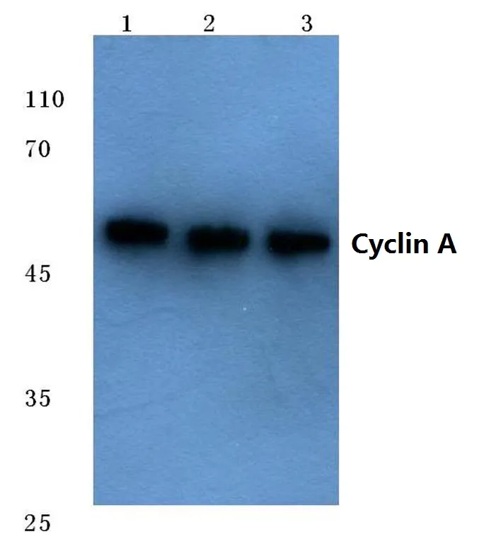 Cyclin A2 (CCNA2) Rabbit Polyclonal Antibody - image 1