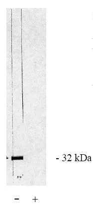 PPP6C Rabbit Polyclonal Antibody - image 1