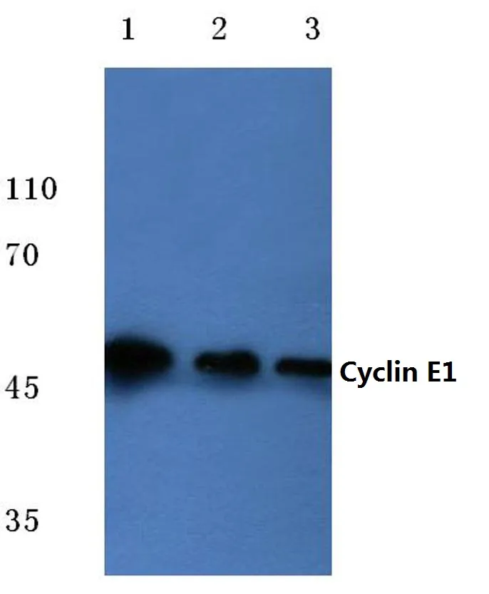 Cyclin E1 (CCNE1) Rabbit Polyclonal Antibody - image 1