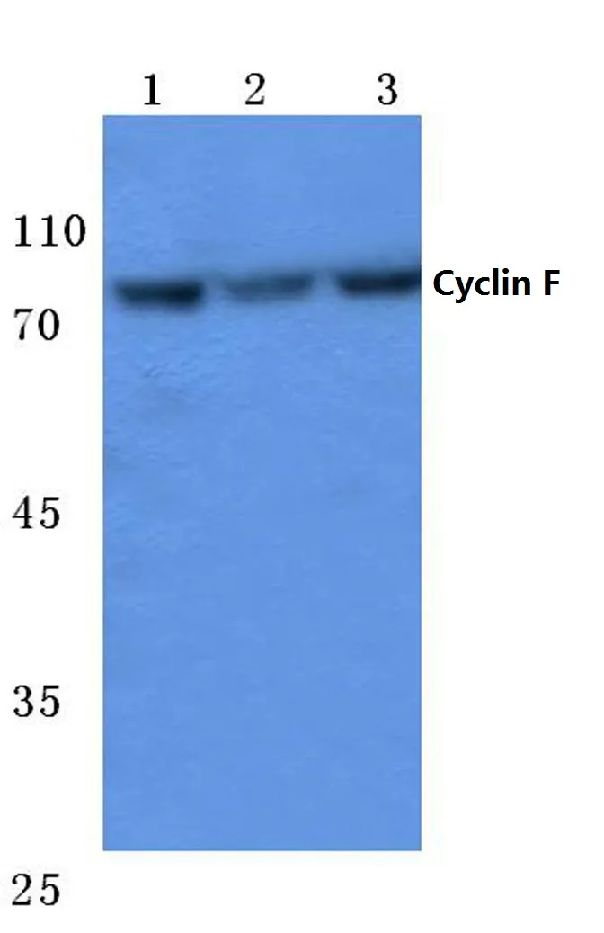 Cyclin F (CCNF) Rabbit Polyclonal Antibody - image 1