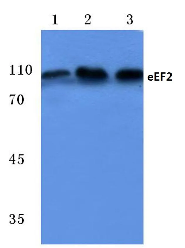 EEF2 Rabbit Polyclonal Antibody - image 1