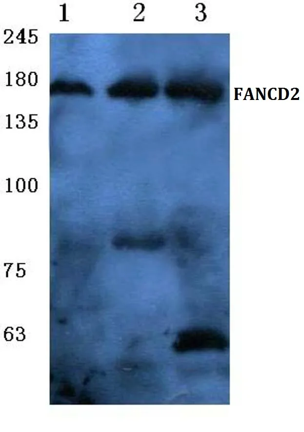 FANCD2 Rabbit Polyclonal Antibody - image 1