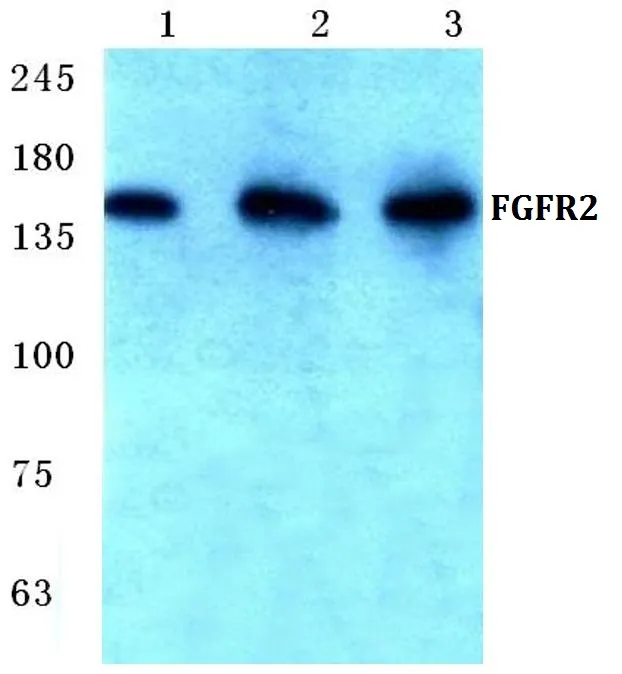 FGFR2 Rabbit Polyclonal Antibody - image 1