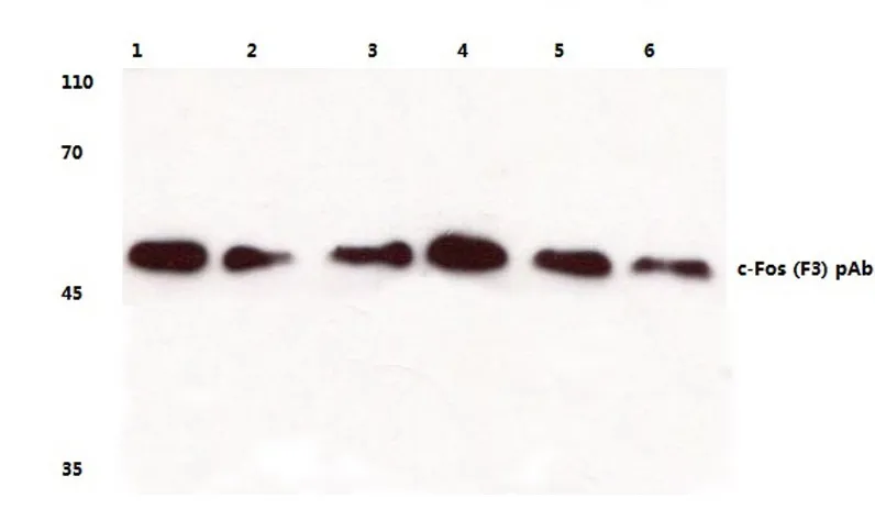 c Fos (FOS) Rabbit Polyclonal Antibody - image 1