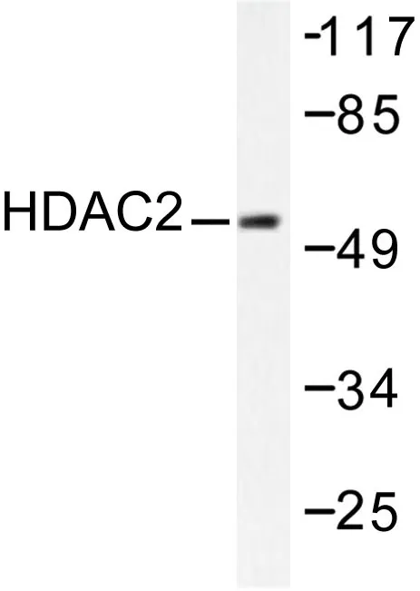 HDAC2 Rabbit Polyclonal Antibody - image 1