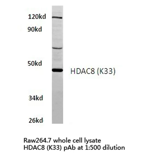 HDAC8 Rabbit Polyclonal Antibody - image 1