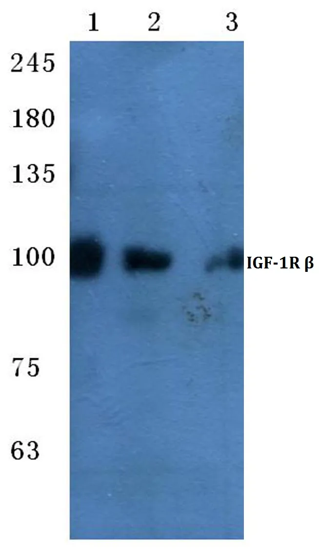 IGF1 Receptor (IGF1R) Rabbit Polyclonal Antibody - image 1
