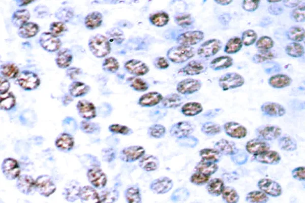 JUNB Rabbit Polyclonal Antibody - image 1