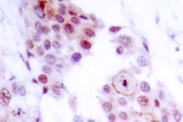 MEF2A Rabbit Polyclonal Antibody - image 1