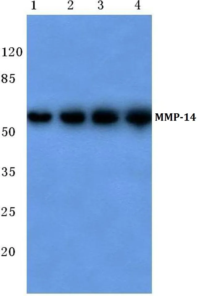 MMP14 Rabbit Polyclonal Antibody - image 1