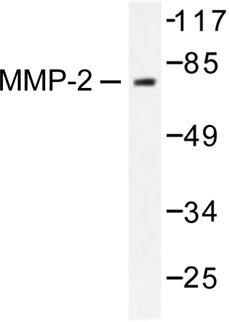 MMP2 Rabbit Polyclonal Antibody - image 1
