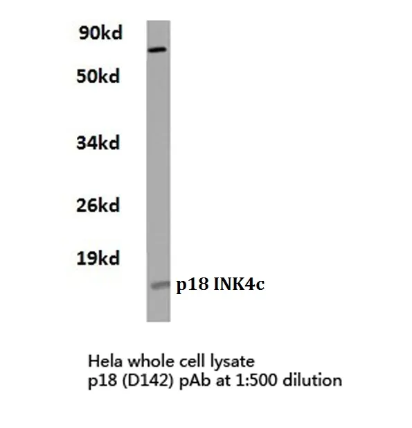 p18 INK4c (CDKN2C) Rabbit Polyclonal Antibody - image 1