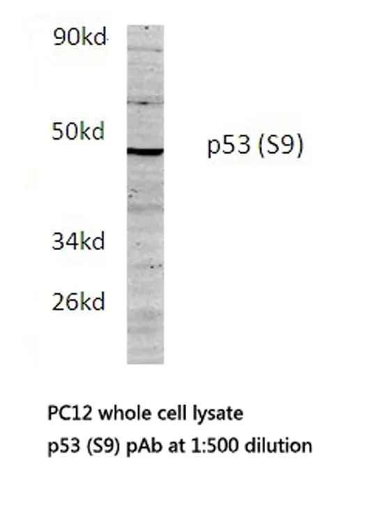 p53 (TP53) Rabbit Polyclonal Antibody - image 1