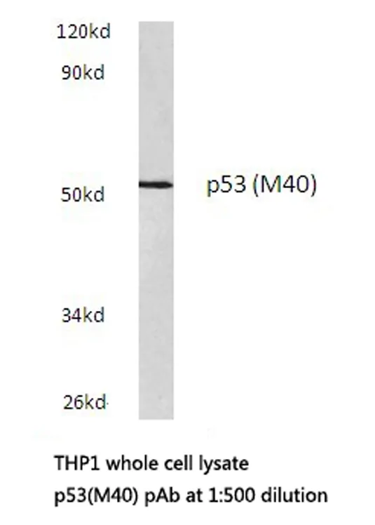 p53 (TP53) Rabbit Polyclonal Antibody - image 1