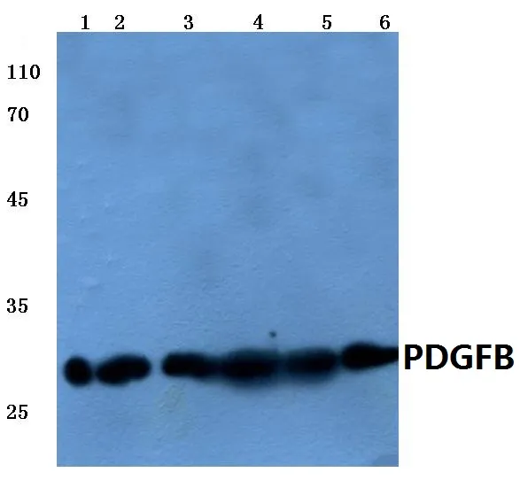 PDGF beta (PDGFB) Rabbit Polyclonal Antibody - image 1
