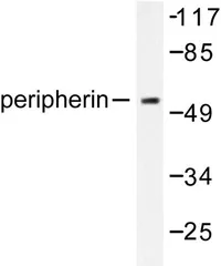 Peripherin (PRPH) Rabbit Polyclonal Antibody - image 1