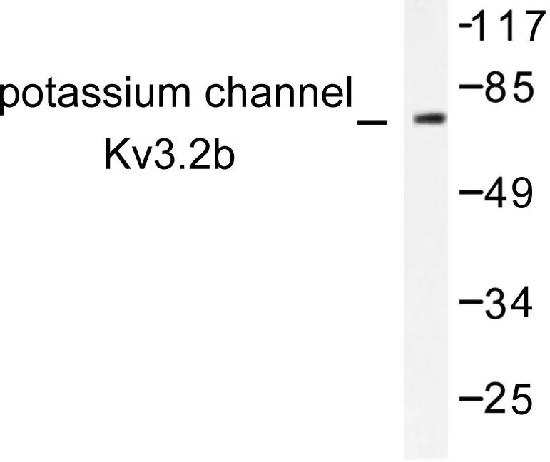 Kv3.2 (KCNC2) Rabbit Polyclonal Antibody - image 1