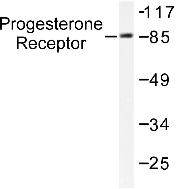 Progesterone Receptor (PGR) Rabbit Polyclonal Antibody - image 1